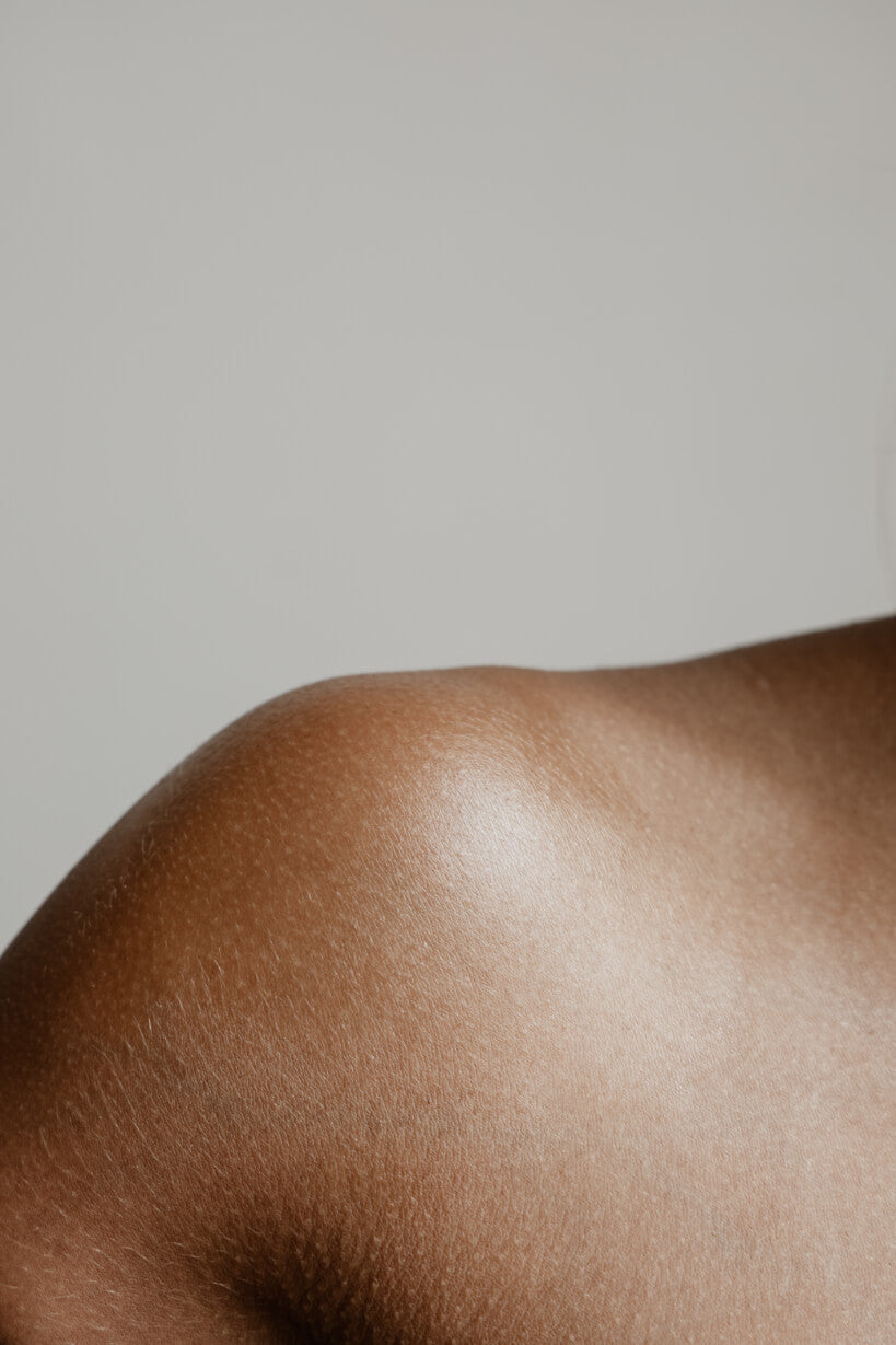 Droge huid more natural