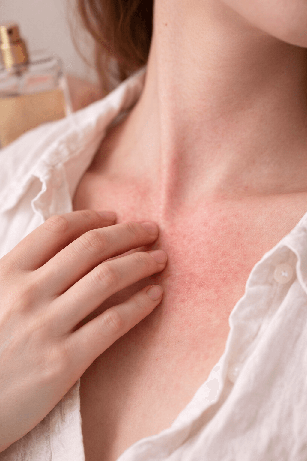 Triggers bij een gevoelige huid en waarom ze effect hebben