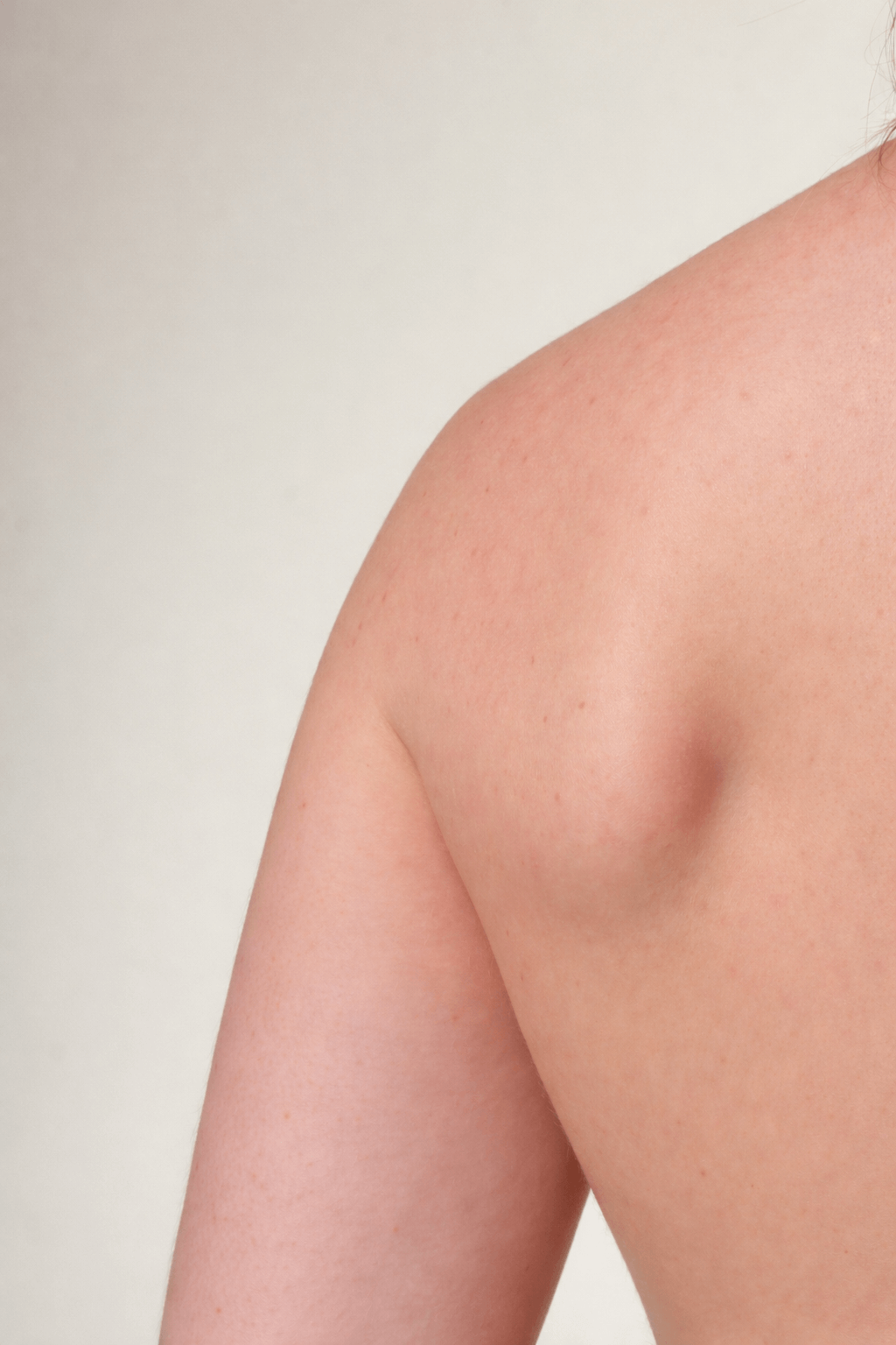 Waarom een gevoelige huid sneller reageert op prikkels